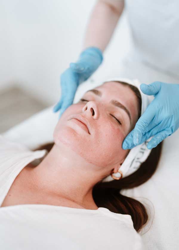 Microneedling_2 Microneedling_2